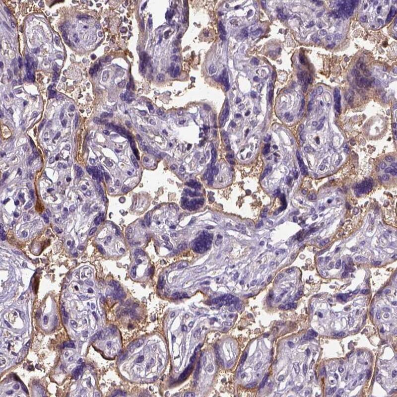 Endoglin/CD105 Antibody - BSA Free Immunohistochemistry: Endoglin/CD105 Antibody - BSA Free [NBP1-91212]