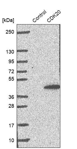 CDK20 Antibody - BSA Free Western Blot: CDK20 Antibody - BSA Free [NBP1-91213]