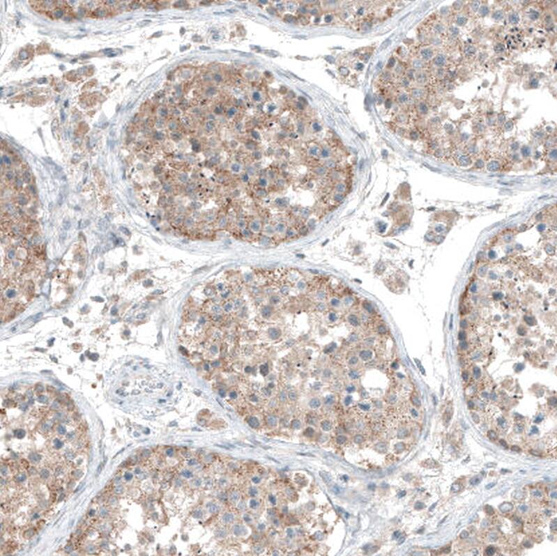 CDK20 Antibody - BSA Free Immunohistochemistry: CDK20 Antibody - BSA Free [NBP1-91214]