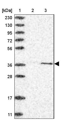 CDK20 Antibody - BSA Free Western Blot: CDK20 Antibody - BSA Free [NBP1-91214]