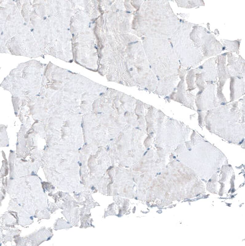 CDK20 Antibody - BSA Free Immunohistochemistry: CDK20 Antibody - BSA Free [NBP1-91214]