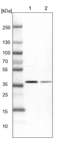 CDK20 Antibody - BSA Free Western Blot: CDK20 Antibody - BSA Free [NBP1-91214]