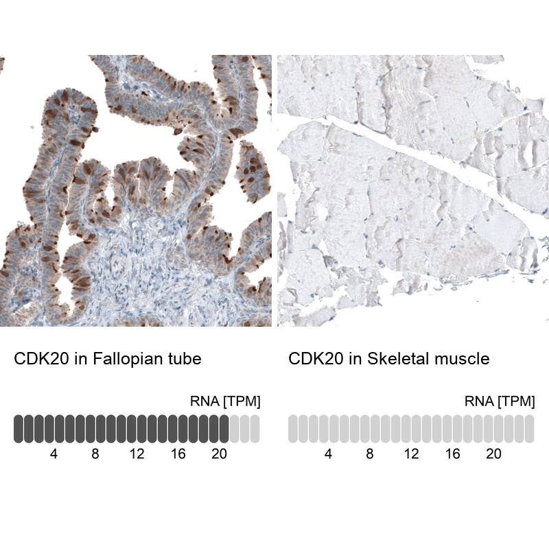 CDK20 Antibody - BSA Free Immunohistochemistry: CDK20 Antibody - BSA Free [NBP1-91214]