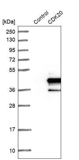 CDK20 Antibody - BSA Free Western Blot: CDK20 Antibody - BSA Free [NBP1-91215]