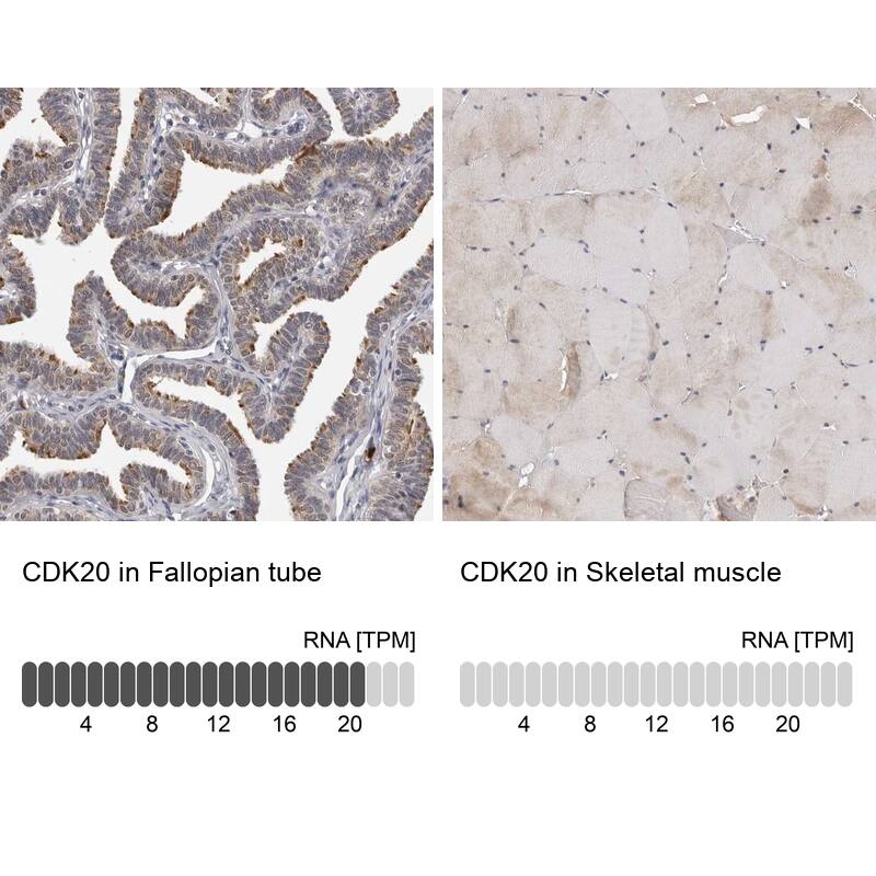 CDK20 Antibody - BSA Free Immunohistochemistry: CDK20 Antibody - BSA Free [NBP1-91215]