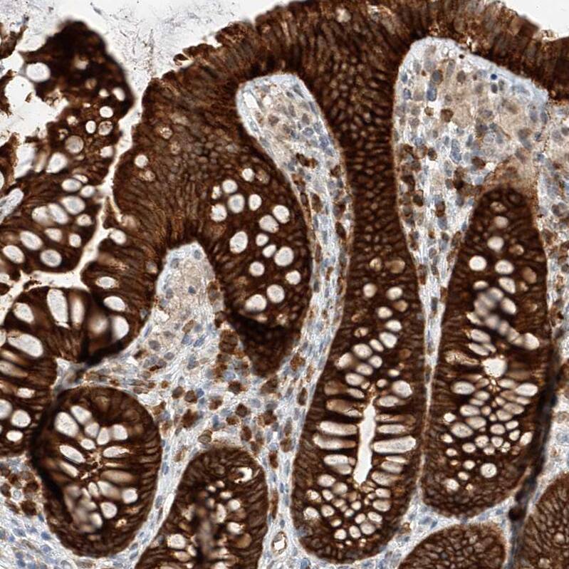 LRRC16A Antibody - BSA Free Immunohistochemistry: LRRC16A Antibody - BSA Free [NBP1-91221]