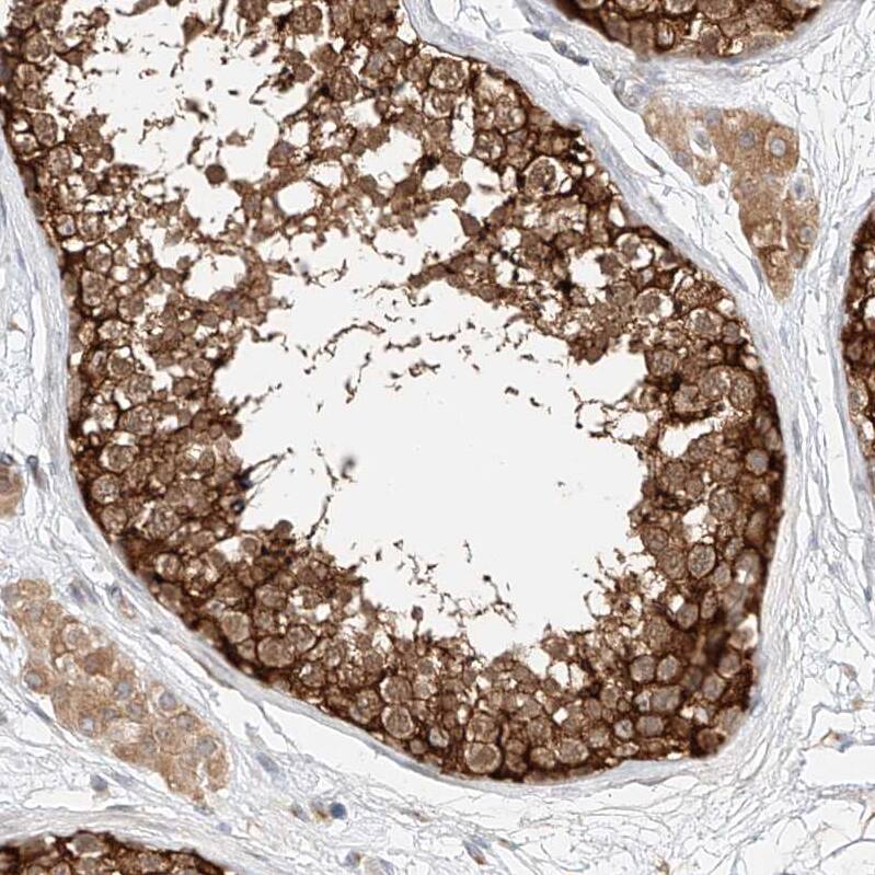 LRRC16A Antibody - BSA Free Immunohistochemistry: LRRC16A Antibody - BSA Free [NBP1-91221]