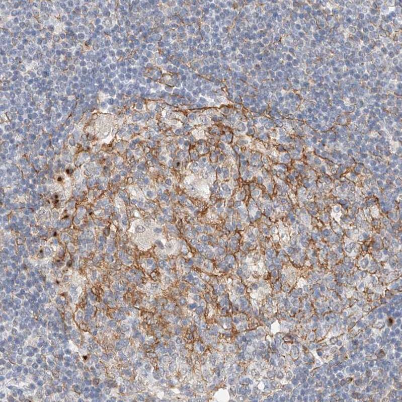 LRRC16A Antibody - BSA Free Immunohistochemistry: LRRC16A Antibody - BSA Free [NBP1-91221]