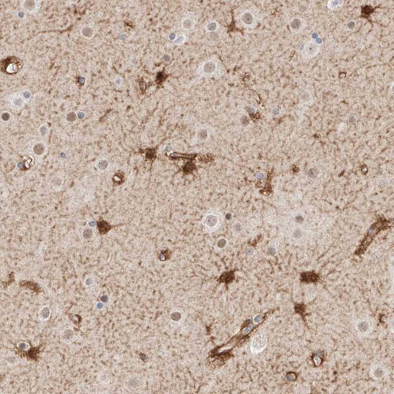 LRRC16A Antibody - BSA Free Immunohistochemistry: LRRC16A Antibody - BSA Free [NBP1-91221]