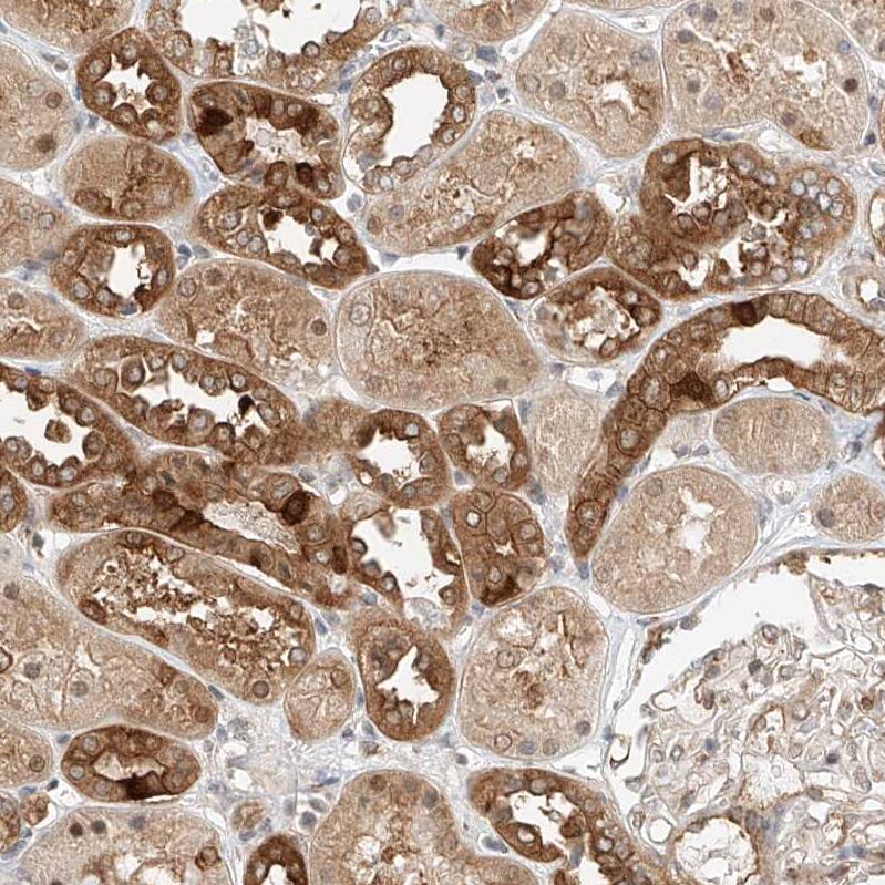 LRRC16A Antibody - BSA Free Immunohistochemistry: LRRC16A Antibody - BSA Free [NBP1-91221]