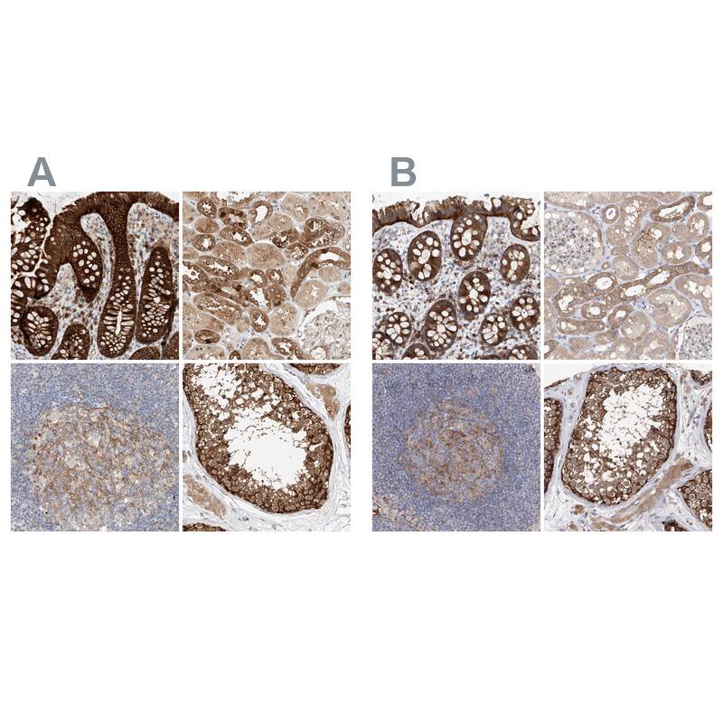 LRRC16A Antibody - BSA Free Immunohistochemistry: LRRC16A Antibody - BSA Free [NBP1-91221]