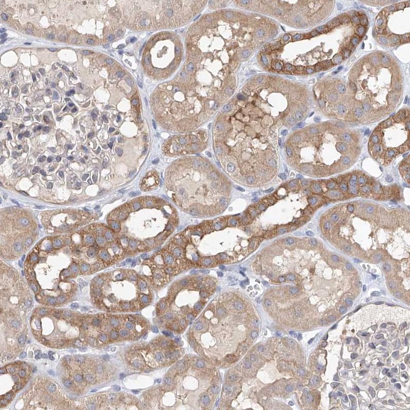 LRRC16A Antibody - BSA Free Immunohistochemistry: LRRC16A Antibody - BSA Free [NBP1-91222]
