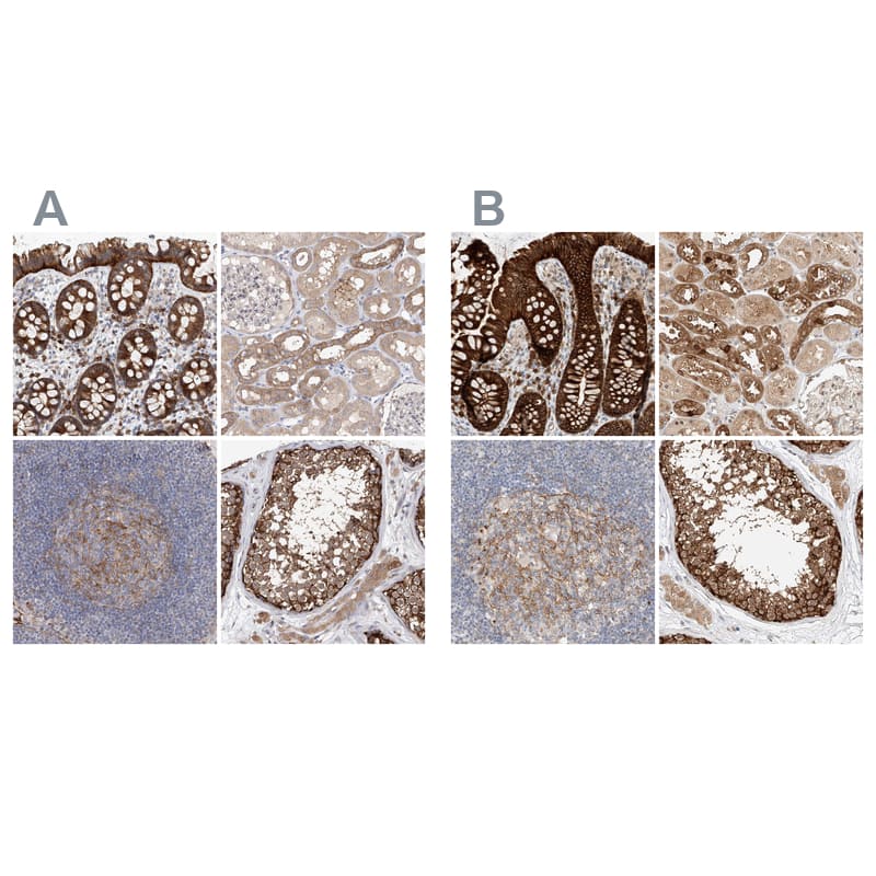 LRRC16A Antibody - BSA Free Immunohistochemistry: LRRC16A Antibody - BSA Free [NBP1-91222]