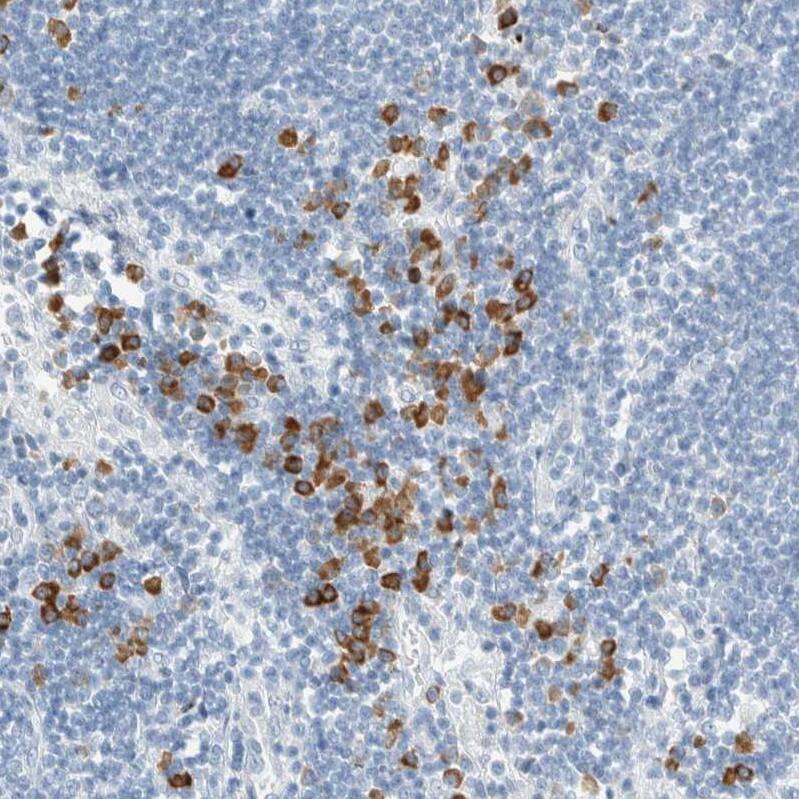 ARHGAP27 Antibody - BSA Free Immunohistochemistry: ARHGAP27 Antibody - BSA Free [NBP1-91223]