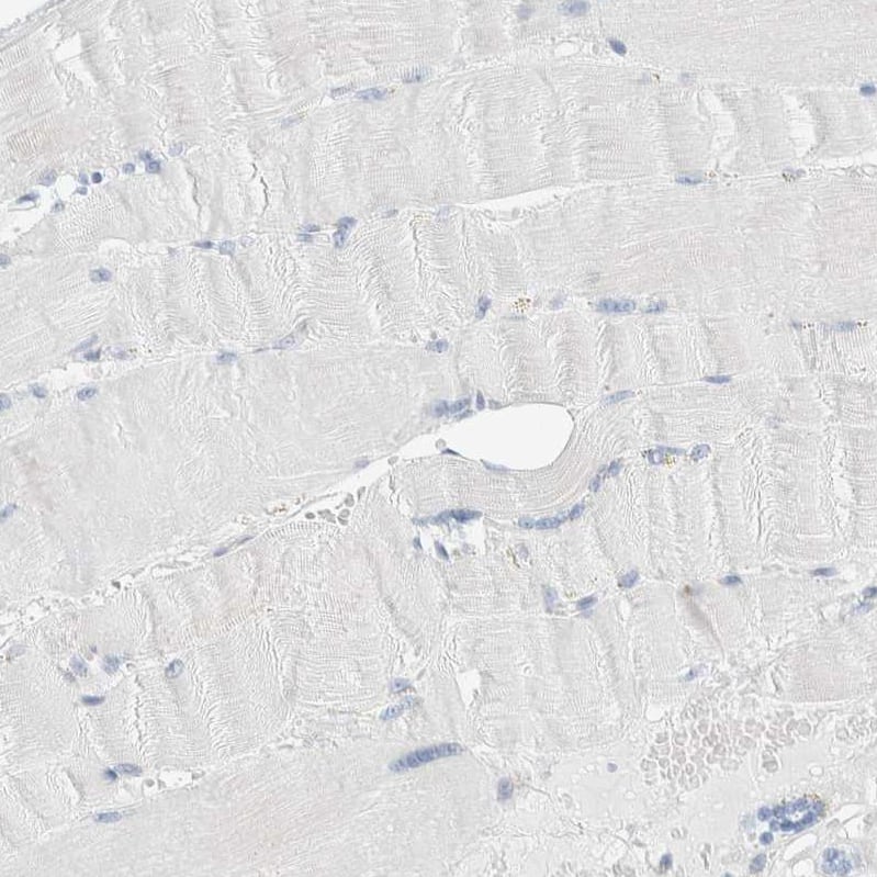 ARHGAP27 Antibody - BSA Free Immunohistochemistry: ARHGAP27 Antibody - BSA Free [NBP1-91223]