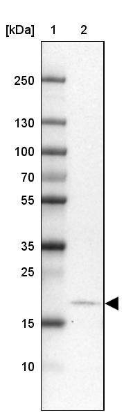 CALY Antibody - BSA Free Western Blot: CALY Antibody - BSA Free [NBP1-91225]