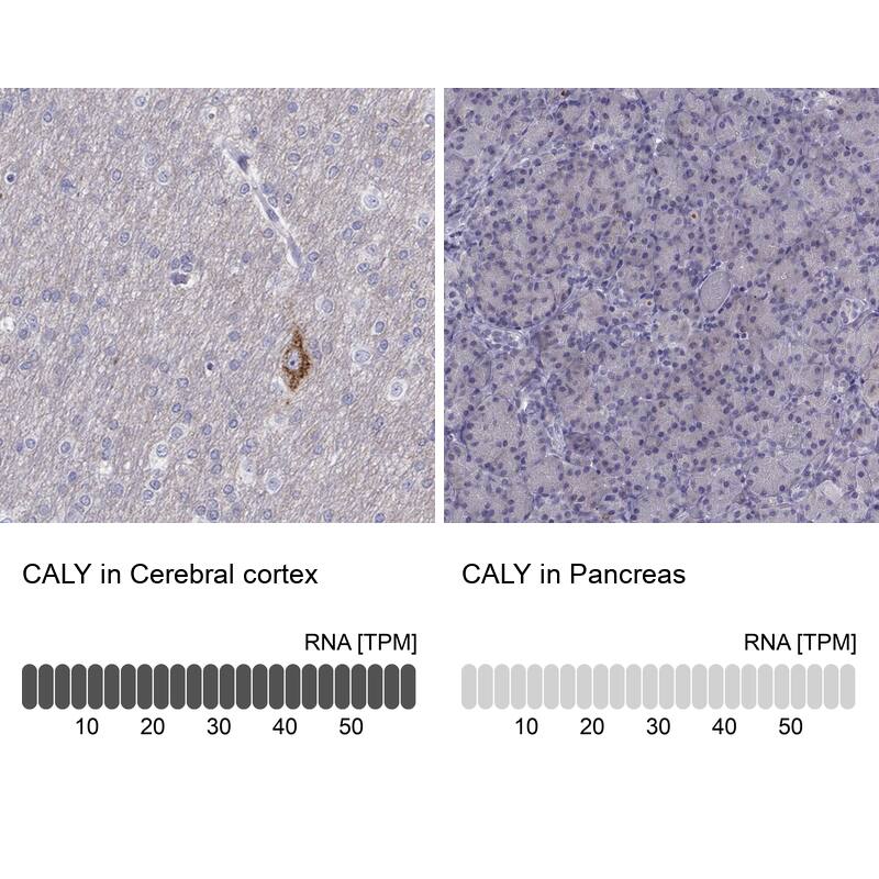 CALY Antibody - BSA Free Immunohistochemistry: CALY Antibody - BSA Free [NBP1-91225]