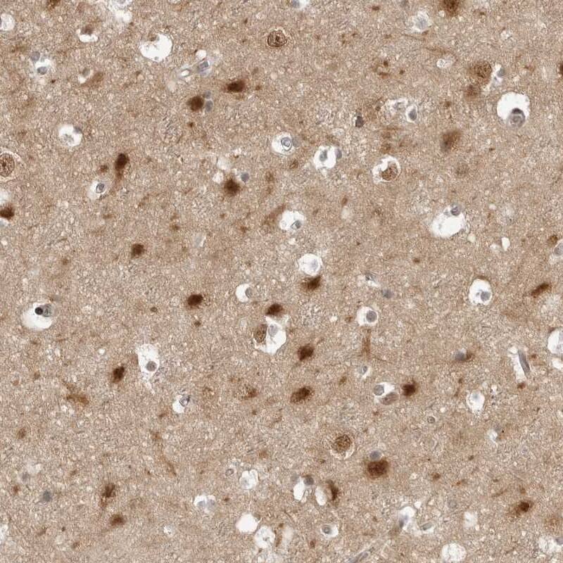 PYK2/FAK2 Antibody - BSA Free Immunohistochemistry-Paraffin: PYK2/FAK2 Antibody [NBP1-91228]