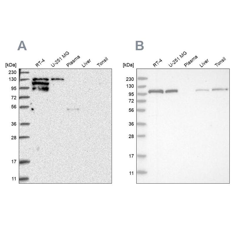 PYK2/FAK2 Antibody - BSA Free Western Blot: PYK2/FAK2 Antibody - BSA Free [NBP1-91228]