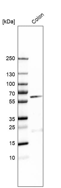 B4GALNT2 Antibody - BSA Free Western Blot: B4GALNT2 Antibody - BSA Free [NBP1-91229]