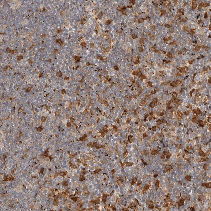 FAM167A Antibody - BSA Free Immunohistochemistry: FAM167A Antibody - BSA Free [NBP1-91237]