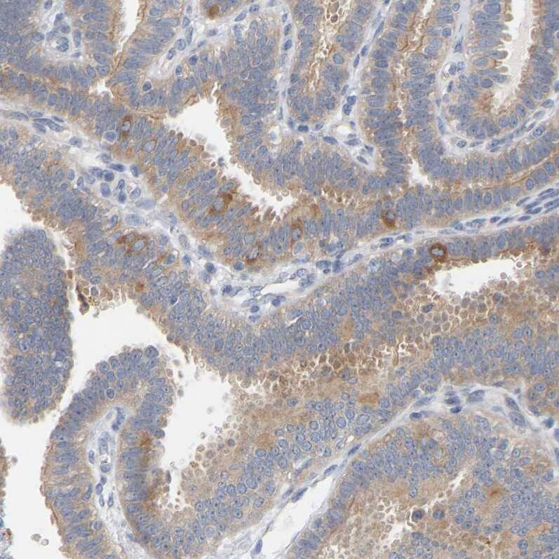 FAM188B Antibody - BSA Free Immunohistochemistry: FAM188B Antibody - BSA Free [NBP1-91239]