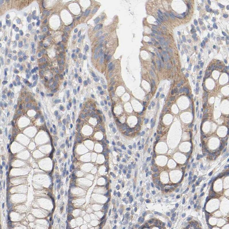FAM188B Antibody - BSA Free Immunohistochemistry: FAM188B Antibody - BSA Free [NBP1-91239]