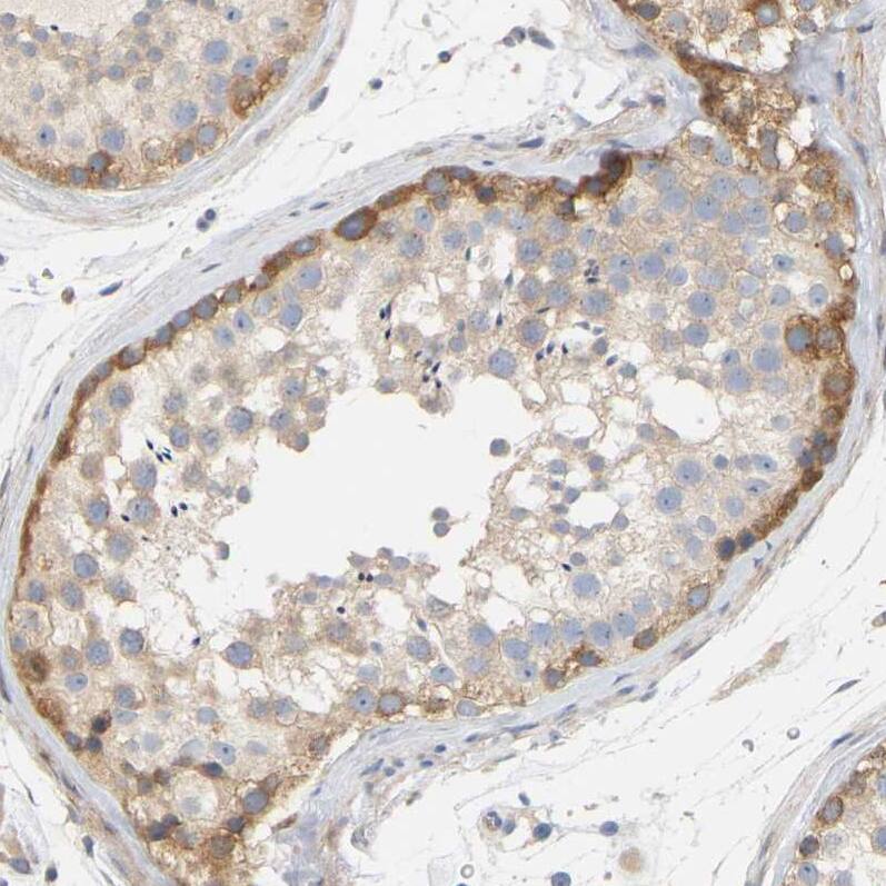 FAM188B Antibody - BSA Free Immunohistochemistry: FAM188B Antibody - BSA Free [NBP1-91239]