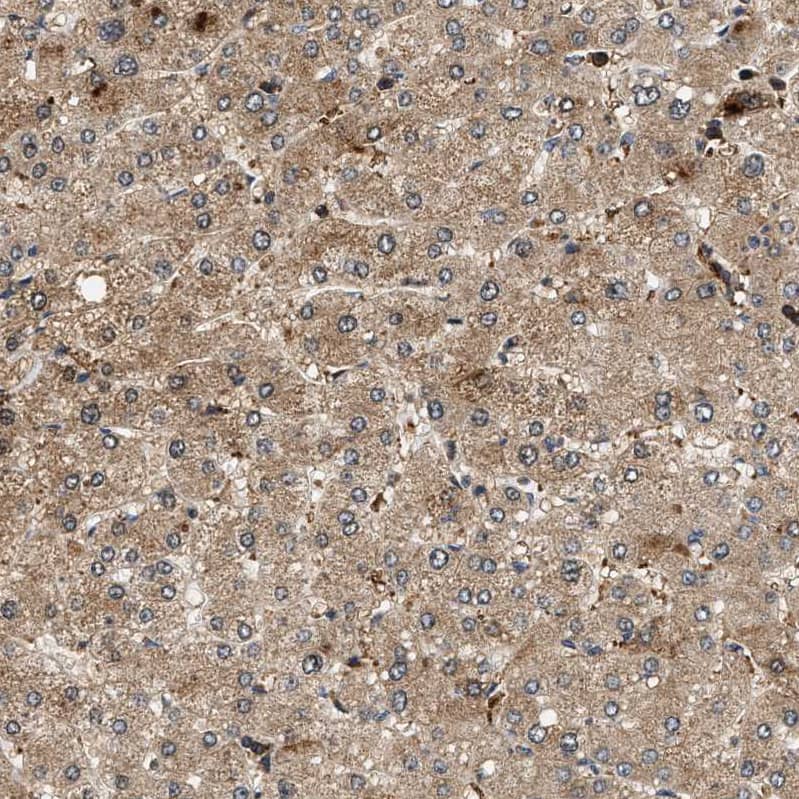 SAMD9 Antibody - BSA Free Immunohistochemistry: SAMD9 Antibody - BSA Free [NBP1-91245]
