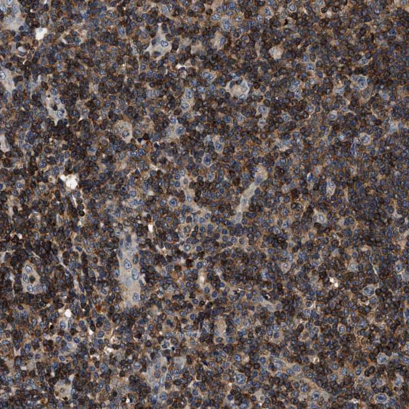 SAMD9 Antibody - BSA Free Immunohistochemistry: SAMD9 Antibody - BSA Free [NBP1-91245]