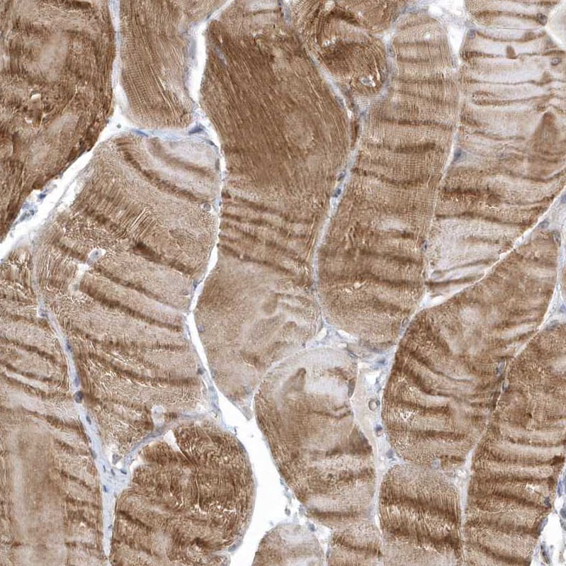 ZC3H12D Antibody - BSA Free Immunohistochemistry: ZC3H12D Antibody - BSA Free [NBP1-91249]