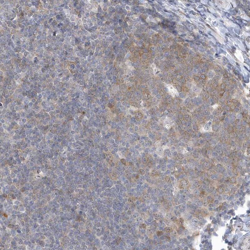 ZC3H12D Antibody - BSA Free Immunohistochemistry: ZC3H12D Antibody - BSA Free [NBP1-91249]