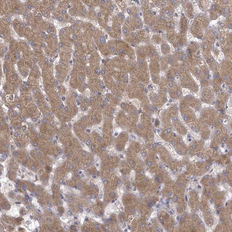 ZC3H12D Antibody - BSA Free Immunohistochemistry: ZC3H12D Antibody - BSA Free [NBP1-91249]