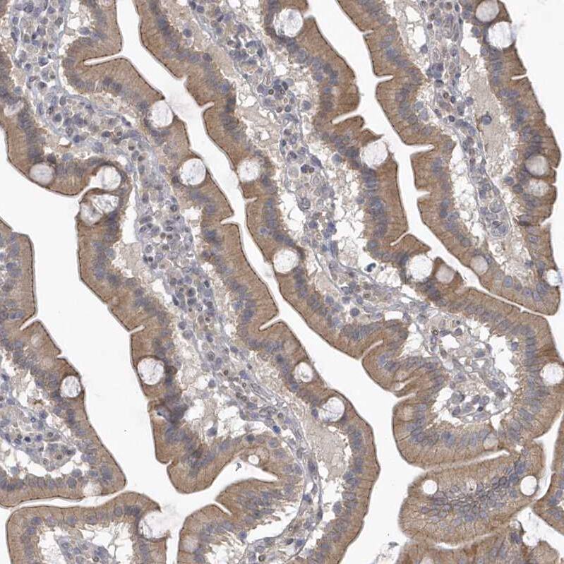 ZC3H12D Antibody - BSA Free Immunohistochemistry: ZC3H12D Antibody - BSA Free [NBP1-91249]