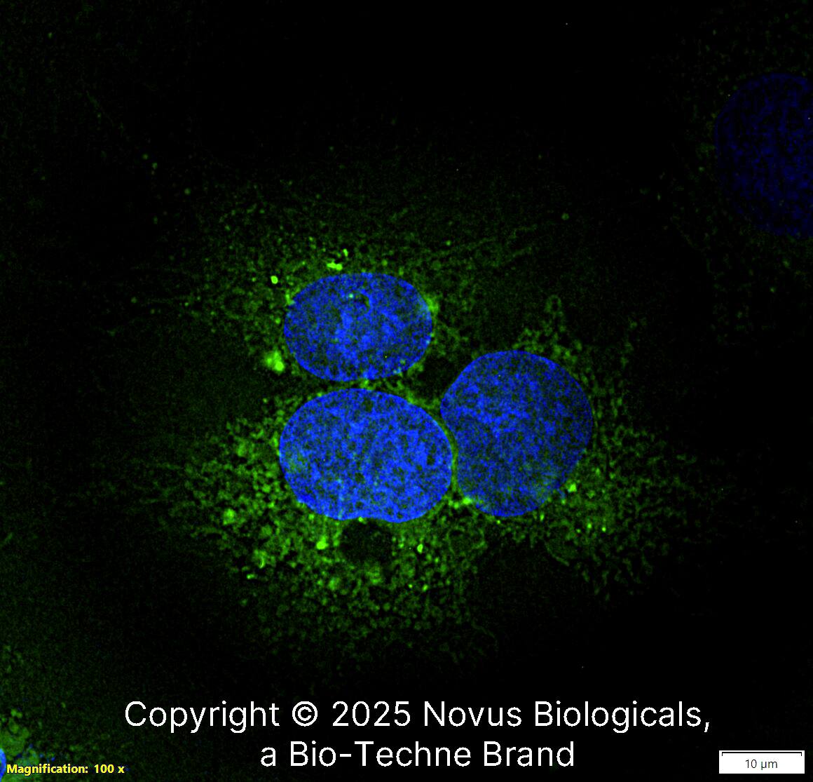 Fibronectin Antibody [FITC]