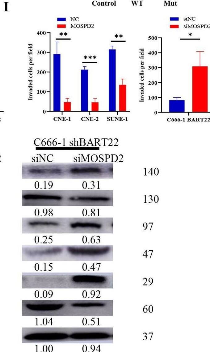 MOSPD2 Antibody - BSA Free