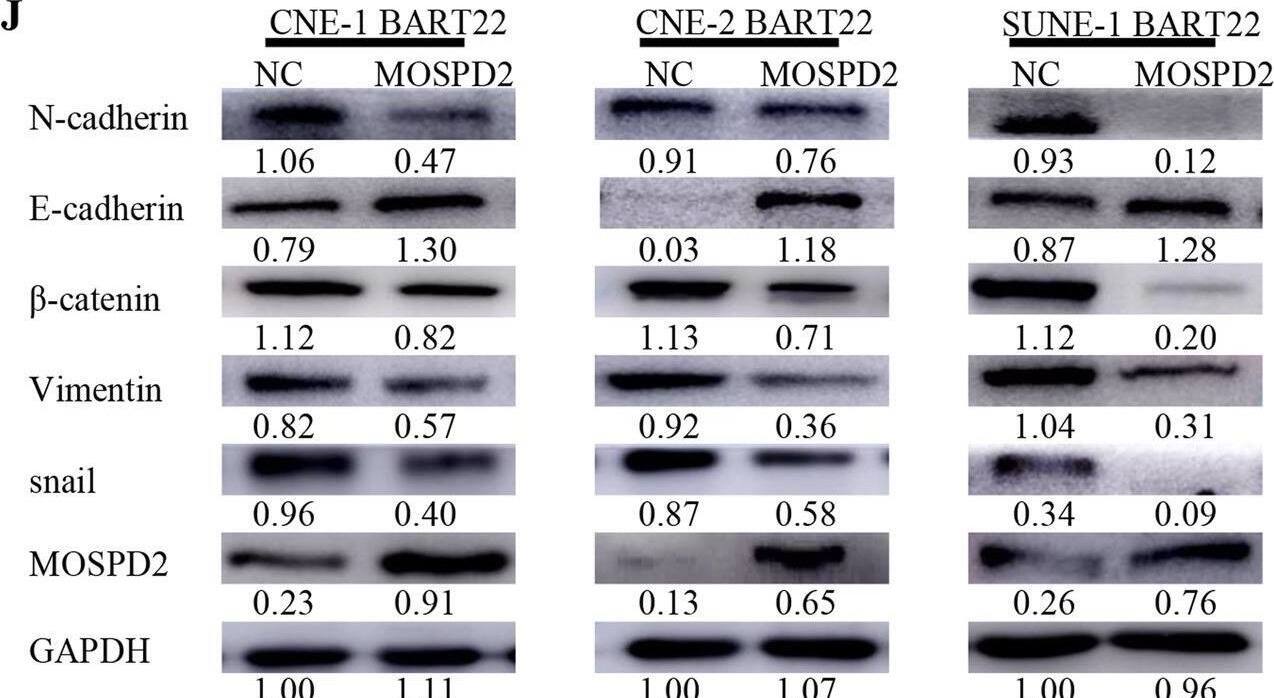 MOSPD2 Antibody - BSA Free
