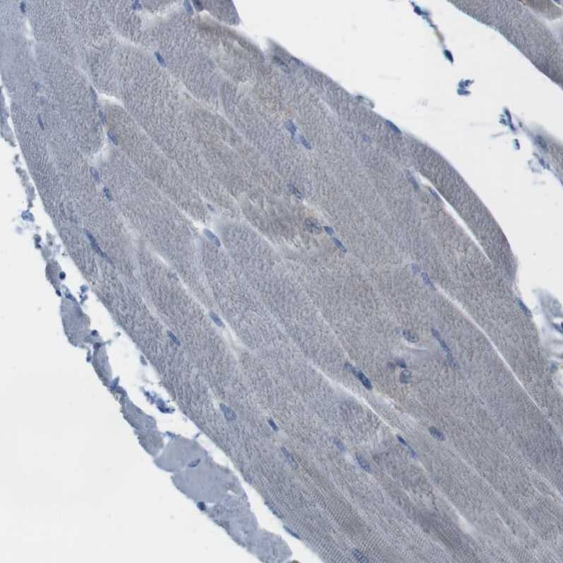 MARCH1 Antibody - BSA Free Immunohistochemistry-Paraffin: MARCH1 Antibody [NBP1-91637]