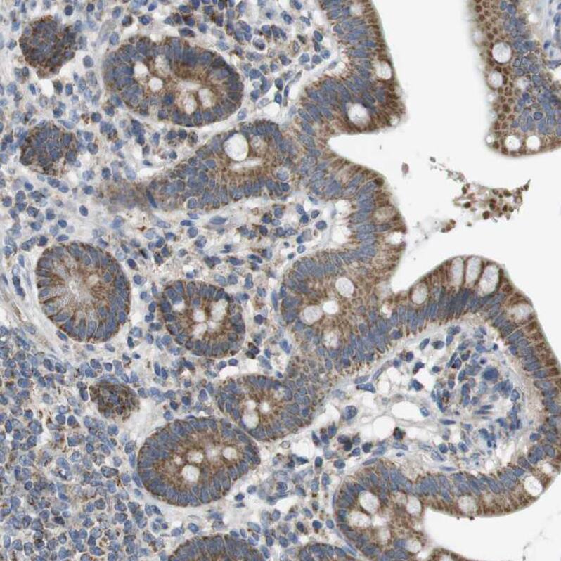 MARCH1 Antibody - BSA Free Immunohistochemistry-Paraffin: MARCH1 Antibody [NBP1-91637]
