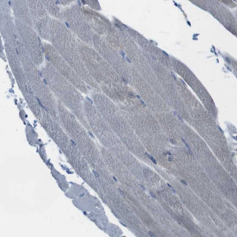 MARCH1 Antibody - BSA Free Immunohistochemistry: MARCH1 Antibody - BSA Free [NBP1-91637]