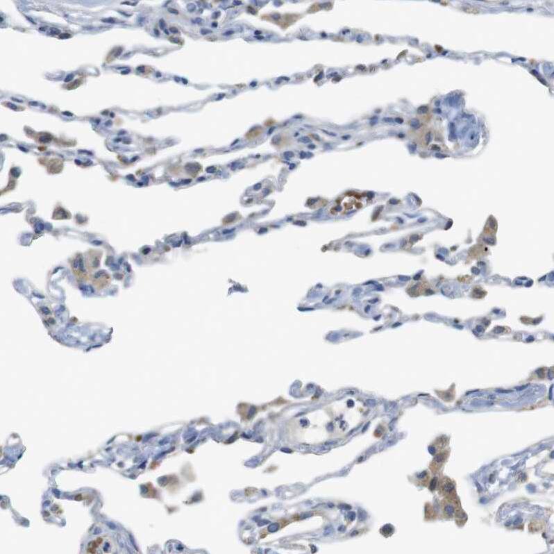 MARCH1 Antibody - BSA Free Immunohistochemistry: MARCH1 Antibody - BSA Free [NBP1-91637]