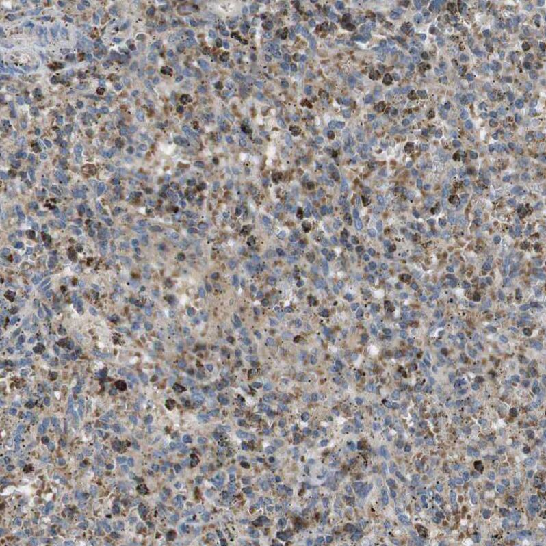 MARCH1 Antibody - BSA Free Immunohistochemistry: MARCH1 Antibody - BSA Free [NBP1-91637]
