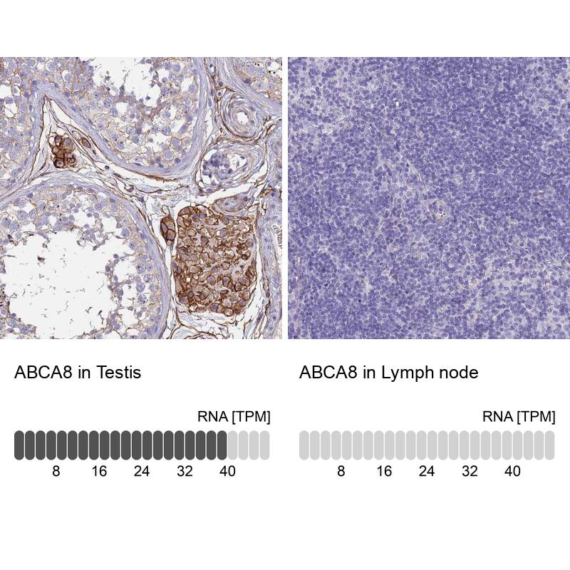 ABCA8 Antibody - BSA Free Immunohistochemistry: ABCA8 Antibody - BSA Free [NBP1-91641]
