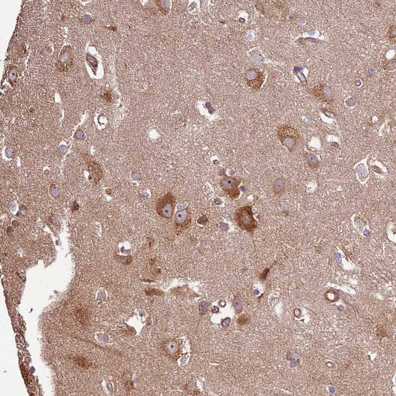 Activin RIIA Antibody - BSA Free Immunohistochemistry: Activin RIIA Antibody - BSA Free [NBP1-91647]