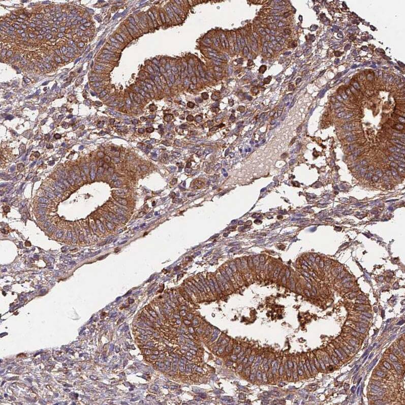 Activin RIIA Antibody - BSA Free Immunohistochemistry: Activin RIIA Antibody - BSA Free [NBP1-91647]