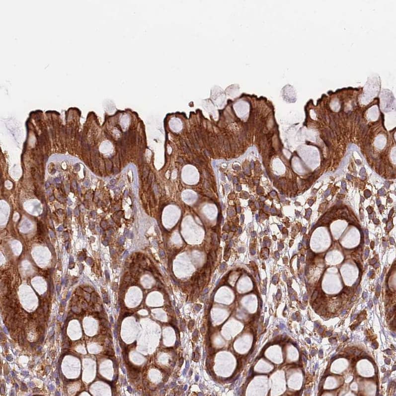 Activin RIIA Antibody - BSA Free Immunohistochemistry: Activin RIIA Antibody - BSA Free [NBP1-91647]