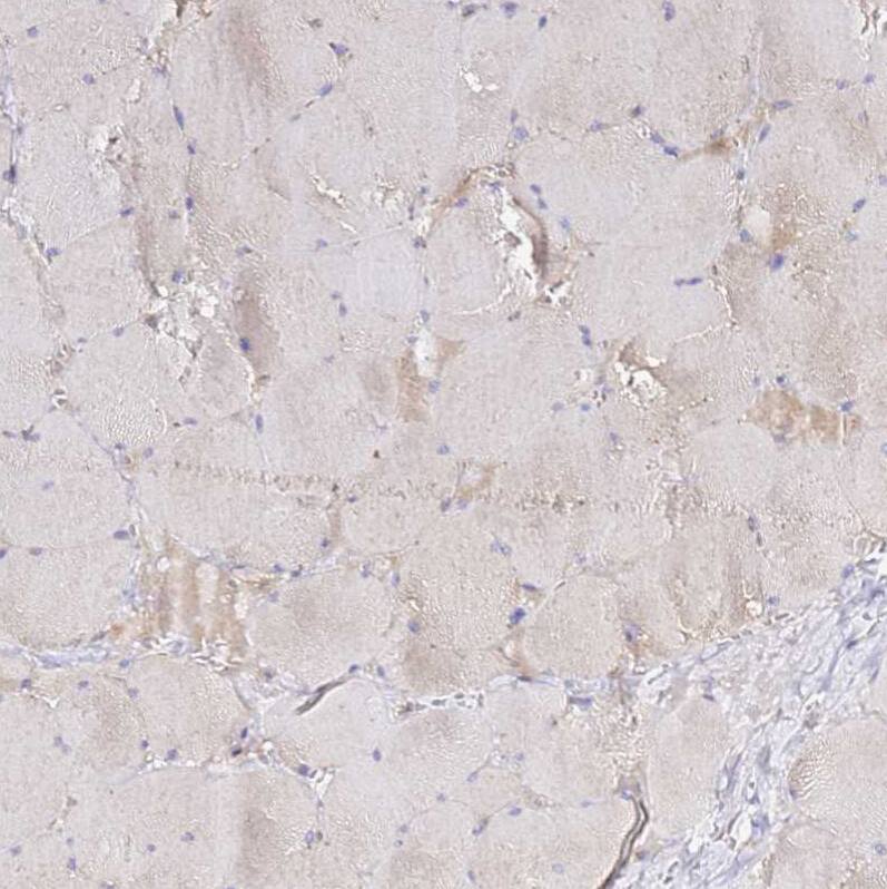 ADPGK Antibody - BSA Free Immunohistochemistry: ADPGK Antibody - BSA Free [NBP1-91653]
