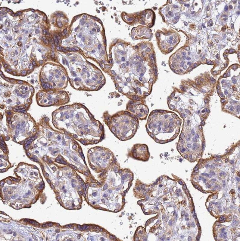 ADPGK Antibody - BSA Free Immunohistochemistry: ADPGK Antibody - BSA Free [NBP1-91653]