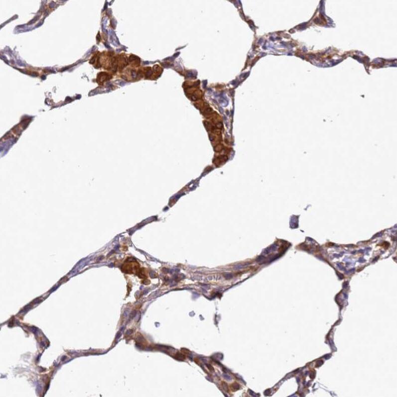 ADPGK Antibody - BSA Free Immunohistochemistry: ADPGK Antibody - BSA Free [NBP1-91653]