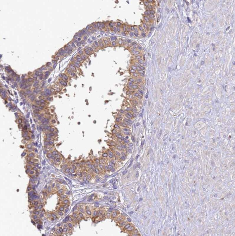 ADPGK Antibody - BSA Free Immunohistochemistry: ADPGK Antibody - BSA Free [NBP1-91653]